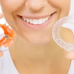 Nakładki Invisalign w Warszawie