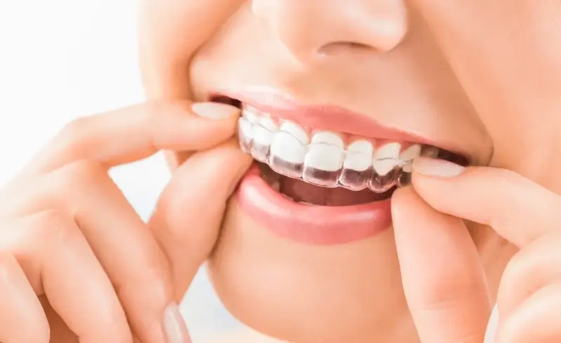 Endodoncja stomatologiczna Szczecin