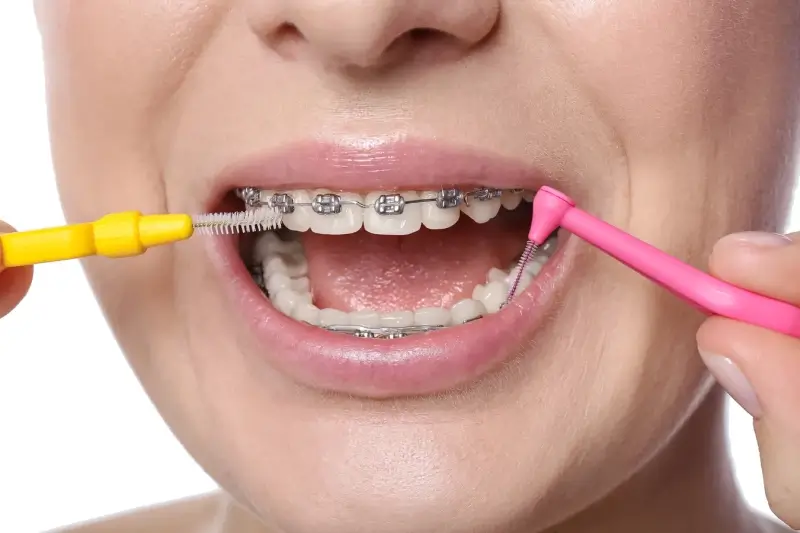 Wybór dobrego dentysty