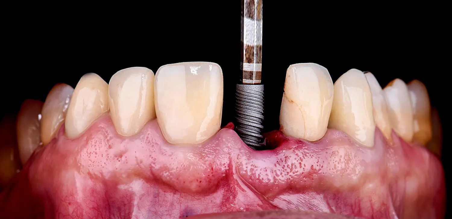 Dentysta - piękny uśmiech, białe zęby