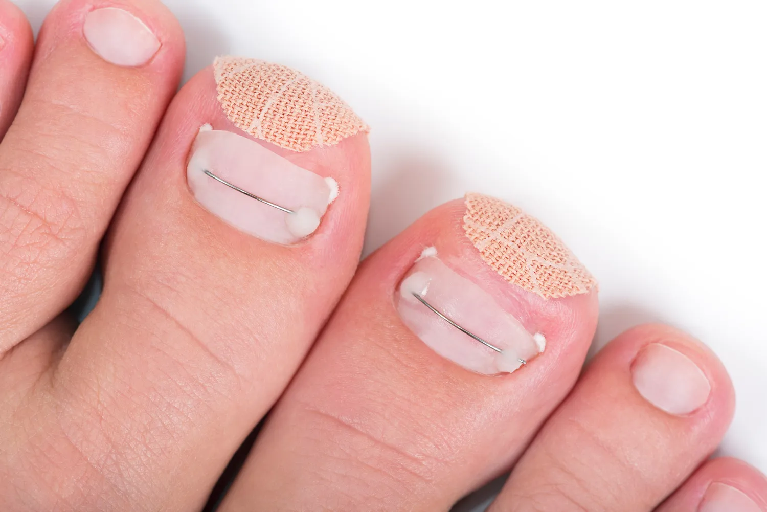 Pedicure podologiczne Warszawa
