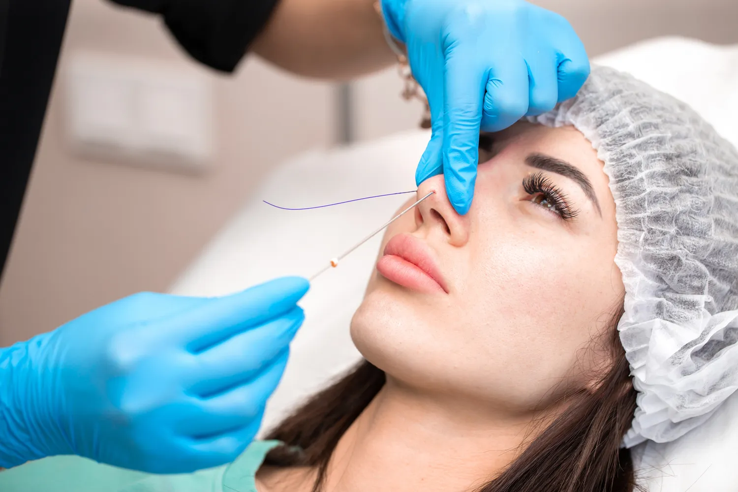 E recepta na czym polega?