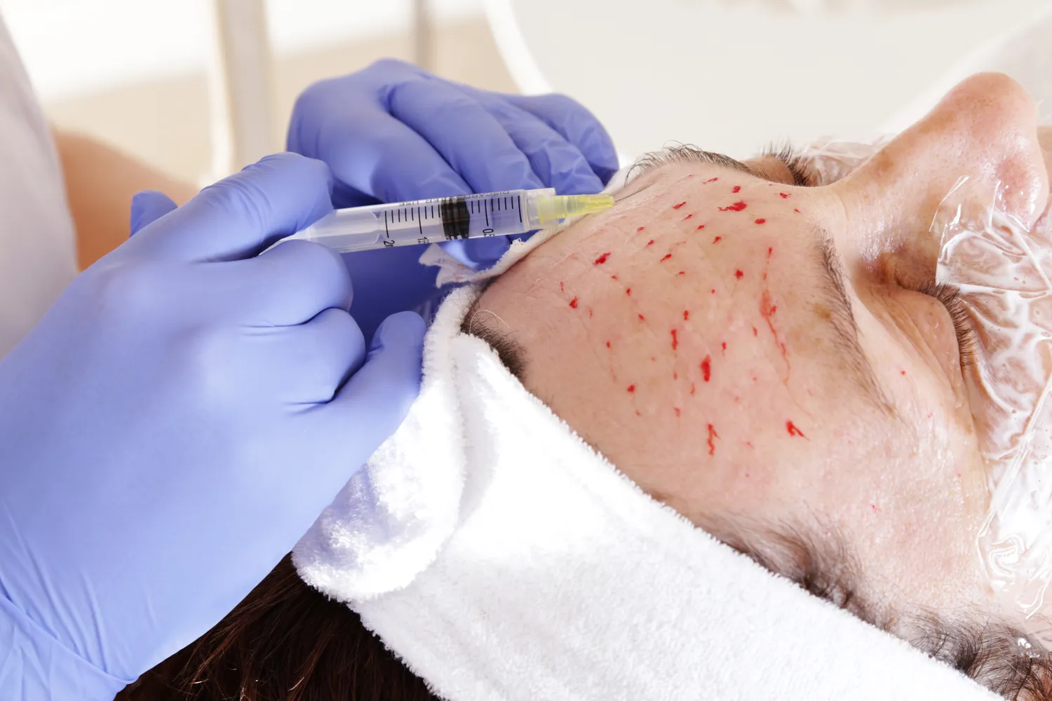 Medycyna estetyczna Szczecin